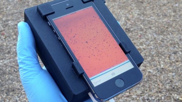 Researchers led by a team at the University of California, Berkeley, have developed the CellScope, a smartphone microscope capable of detecting parasites in a drop of blood - Sputnik International