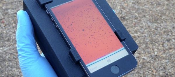 Researchers led by a team at the University of California, Berkeley, have developed the CellScope, a smartphone microscope capable of detecting parasites in a drop of blood Researchers led by a team at the University of California, Berkeley, have developed the CellScope, a smartphone microscope capable of detecting parasites in a drop of blood - Sputnik International