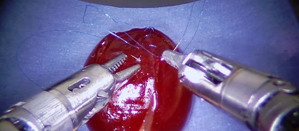 da Vinci Robot Stitches a Grape Back Together da Vinci Robot Stitches a Grape Back Together - Sputnik International