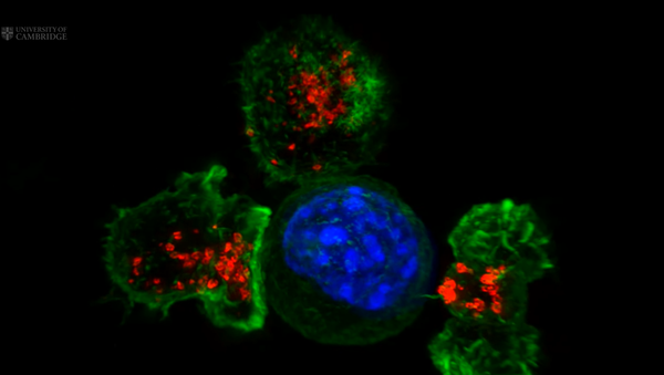 The Only Good Killers: T-Cells Destroy Cancer - Sputnik International