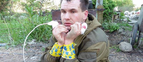 An image of what appears to be a Donbass milita fighter with his index fingers cut off by his Ukrainian captors. An image of what appears to be a Donbass milita fighter with his index fingers cut off by his Ukrainian captors. - Sputnik International