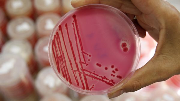 An analytical chemist shows a petri dish with salmonella in the Institute for Chemical and Veterinary Research in Stuttgart, southwestern Germany - Sputnik International