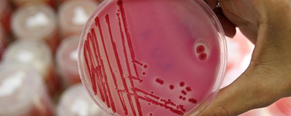 An analytical chemist shows a petri dish with salmonella in the Institute for Chemical and Veterinary Research in Stuttgart, southwestern Germany An analytical chemist shows a petri dish with salmonella in the Institute for Chemical and Veterinary Research in Stuttgart, southwestern Germany - Sputnik International