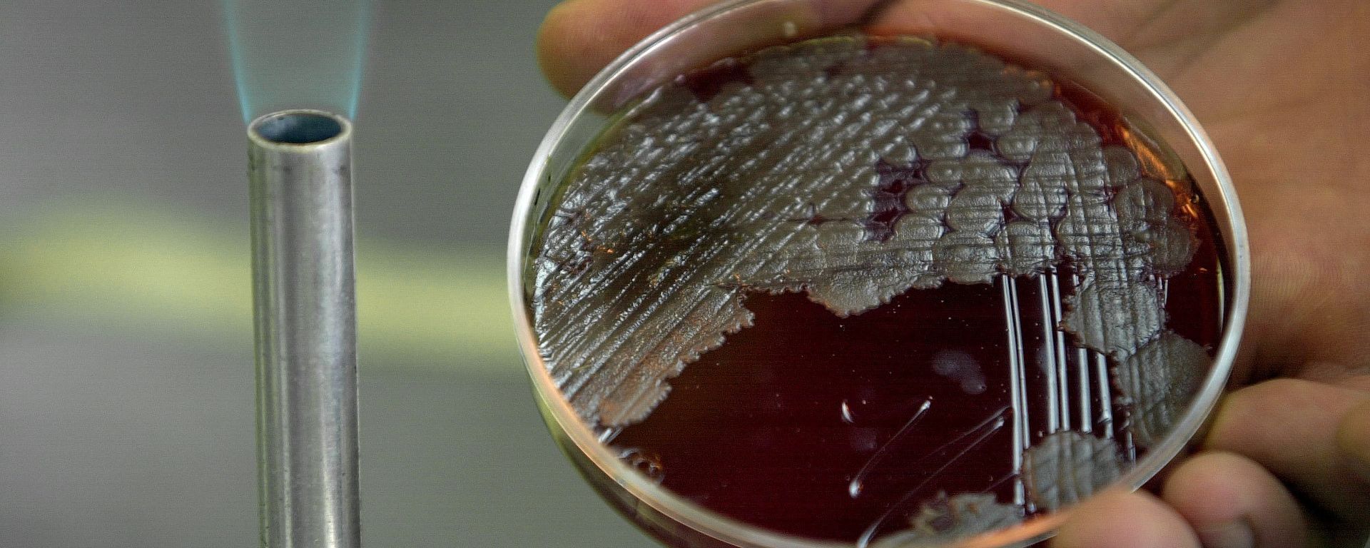 Sample of billions of Anthrax bacteria - Sputnik International, 1920, 13.04.2023