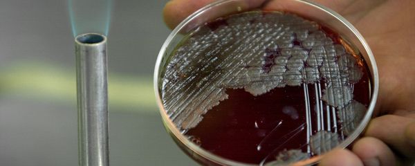 Sample of billions of Anthrax bacteria Sample of billions of Anthrax bacteria - Sputnik International