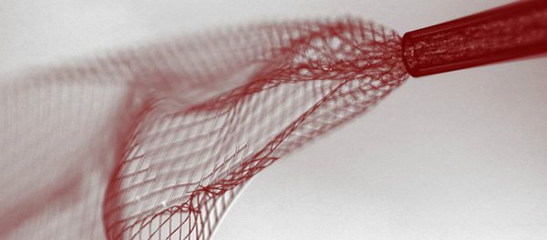 An electronic mesh implant, which can be rolled up and injected into the brains of mice. - Sputnik International