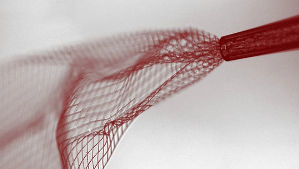 An electronic mesh implant, which can be rolled up and injected into the brains of mice. An electronic mesh implant, which can be rolled up and injected into the brains of mice. - Sputnik International