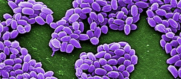 Spores from the Sterne strain of anthrax bacteria (Bacillus anthracis) are pictured in this handout scanning electron micrograph (SEM) obtained by Reuters May 28, 2015 - Sputnik International