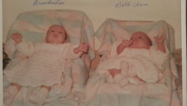 Twins Brenda and Beth Summerfield died eight months apart in 1969 and 1970. - Sputnik International