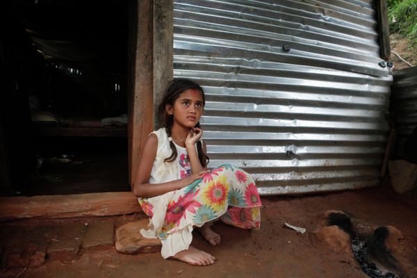 Salina Dahal, who reportedly had a brain surgery soon after the devastating earthquake by CNN's medical correspondent Dr. Sanjay Gupta, sits at her home in Dahal Village. Salina Dahal, who reportedly had a brain surgery soon after the devastating earthquake by CNN's medical correspondent Dr. Sanjay Gupta, sits at her home in Dahal Village. - Sputnik International