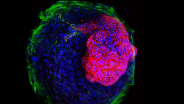 Cardiac Microchamber - Sputnik International