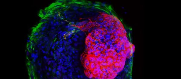 Cardiac Microchamber - Sputnik International