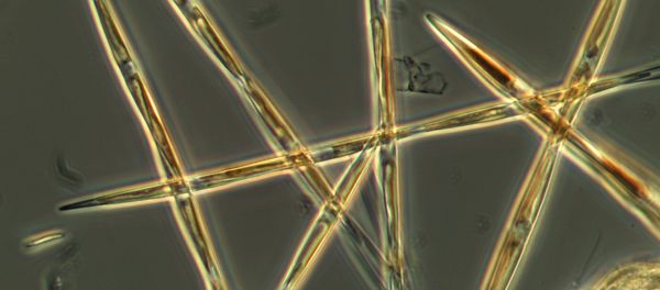 The algae pseudo-nitzchia, which produces the toxic domoic acid, is seen from an algae bloom sample that the NOAA ship Bell M. Shimada collected during its survey this summer on the West Coast. - Sputnik International