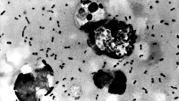 This Centers For Disease Control (CDC) file image obtained 15 January, 2003, shows the bubonic plague bacteria taken from a patient. This Centers For Disease Control (CDC) file image obtained 15 January, 2003, shows the bubonic plague bacteria taken from a patient. - Sputnik International