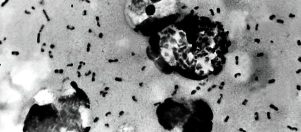 This Centers For Disease Control (CDC) file image obtained 15 January, 2003, shows the bubonic plague bacteria taken from a patient. - Sputnik International