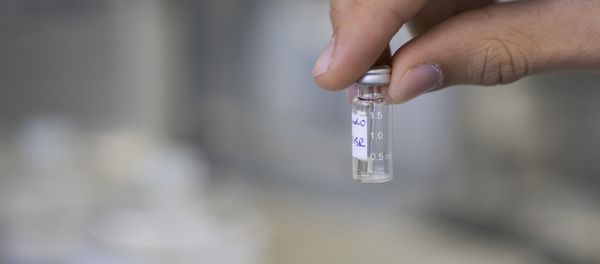 A lab technician shows a sample to be tested for doping A lab technician shows a sample to be tested for doping - Sputnik International