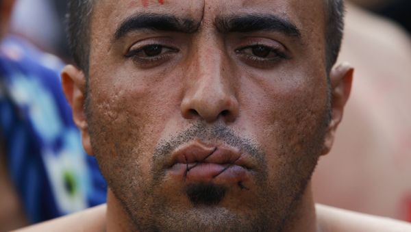 A migrant with his mouth sewn shut in protest sits at the border with Greece near the village of Gevgelija, Macedonia November 23, 2015. A migrant with his mouth sewn shut in protest sits at the border with Greece near the village of Gevgelija, Macedonia November 23, 2015. - Sputnik International