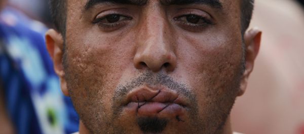 A migrant with his mouth sewn shut in protest sits at the border with Greece near the village of Gevgelija, Macedonia November 23, 2015. - Sputnik International