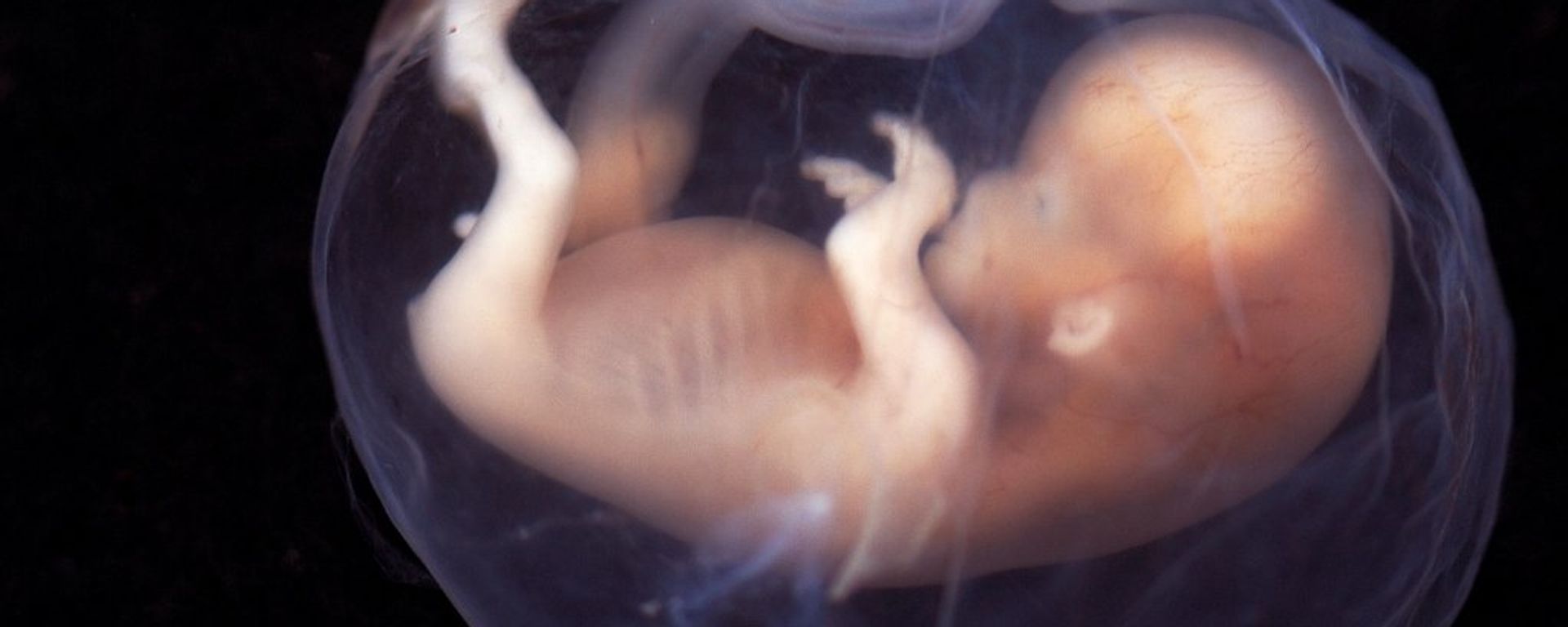 A human embryo - Sputnik International, 1920, 30.05.2022