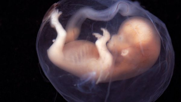 A human embryo - Sputnik International