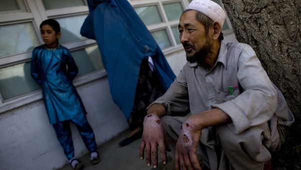 Leishmanisis disease Leishmanisis disease - Sputnik International