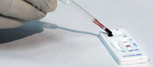 A health agent uses a new test kit that rapidly diagnoses three different mosquito-borne viruses in Sao Paulo, Brazil, January 18, 2016 - Sputnik International