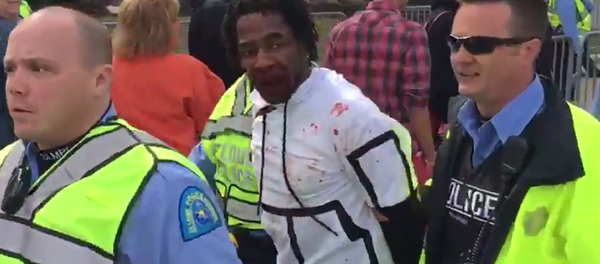 Ferguson Protester Beaten Bloody Outside St. Louis Trump Rally - Sputnik International