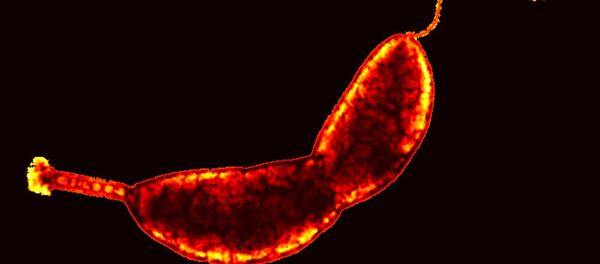 Caulobacter crescentus - Sputnik International