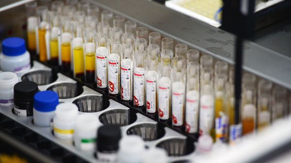 Immunoassay screening lab the blood is tested for infection (hepatitis, syphilis, HIV) on automatic equipment at the Novosibirsk blood donation center - Sputnik International