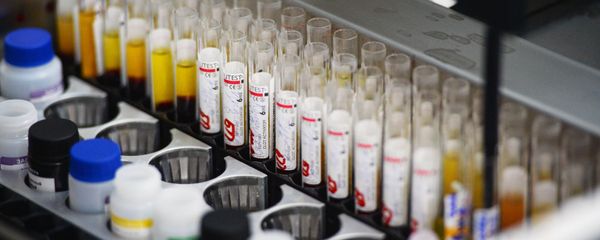 Immunoassay screening lab the blood is tested for infection (hepatitis, syphilis, HIV) on automatic equipment at the Novosibirsk blood donation center Immunoassay screening lab the blood is tested for infection (hepatitis, syphilis, HIV) on automatic equipment at the Novosibirsk blood donation center - Sputnik International