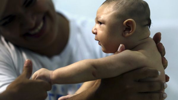 Therapist Rozely Fontoura holds Juan Pedro, who has microcephaly, in Recife, Brazil March 26, 2016 - Sputnik International