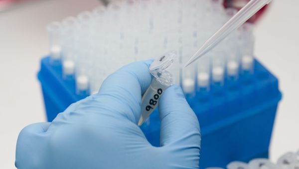 The current Zika outbreak started in Brazil in the spring of 2015 and has since spread across Latin America and the Caribbean. Imported cases were also reported in several European countries and Asia. In February, the World Health Organization declared the Zika virus a global public health emergency. - Sputnik International