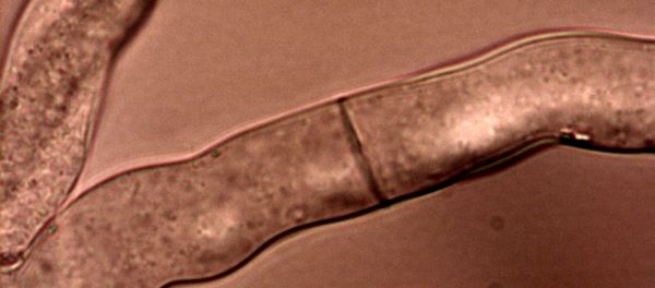 Hyphae of Neurospora crassa with septum and porus Hyphae of Neurospora crassa with septum and porus - Sputnik International