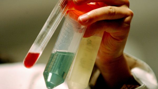 Nano-particle technology - Sputnik International