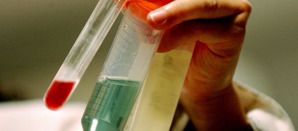 Nano-particle technology - Sputnik International