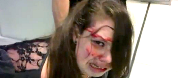 Disabled Woman Beaten Bloody by TSA Disabled Woman Beaten Bloody by TSA - Sputnik International