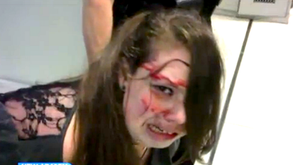 Disabled Woman Beaten Bloody by TSA - Sputnik International