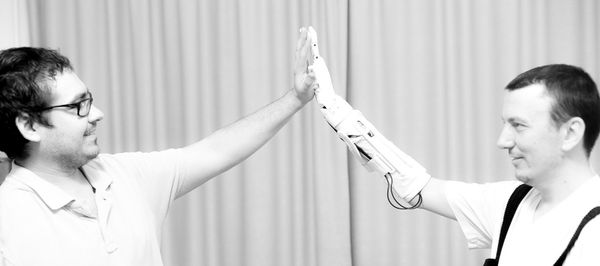Lyashko (L) and a patient with the MaxBionic prosthesis  - Sputnik International