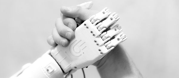 The MaxBionic prosthesis - Sputnik International