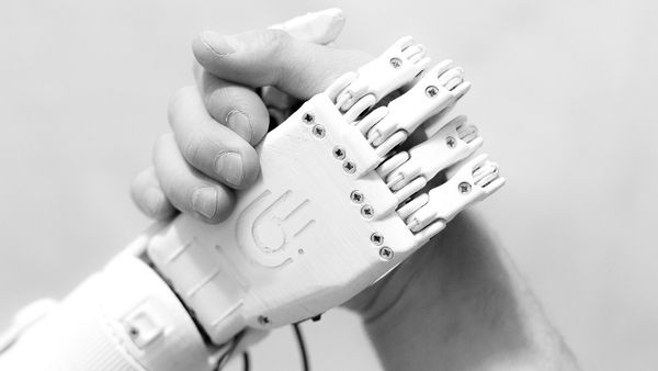 The MaxBionic prosthesis - Sputnik International