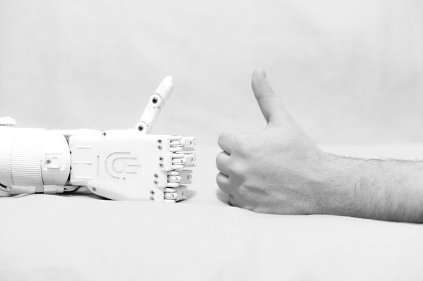 The MaxBionic prosthesis  - Sputnik International