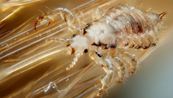 Male human head louse - Sputnik International