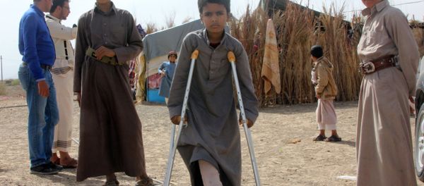 Mabruk Mughrabi (C), a Yemeni boy injured in his leg as a result of a land mine, stands with friends at a camp for internally displaced on the outskirts of Marib on April 15, 2016 - Sputnik International