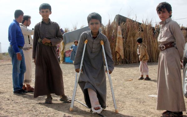 Mabruk Mughrabi (C), a Yemeni boy injured in his leg as a result of a land mine, stands with friends at a camp for internally displaced on the outskirts of Marib on April 15, 2016 Mabruk Mughrabi (C), a Yemeni boy injured in his leg as a result of a land mine, stands with friends at a camp for internally displaced on the outskirts of Marib on April 15, 2016 - Sputnik International