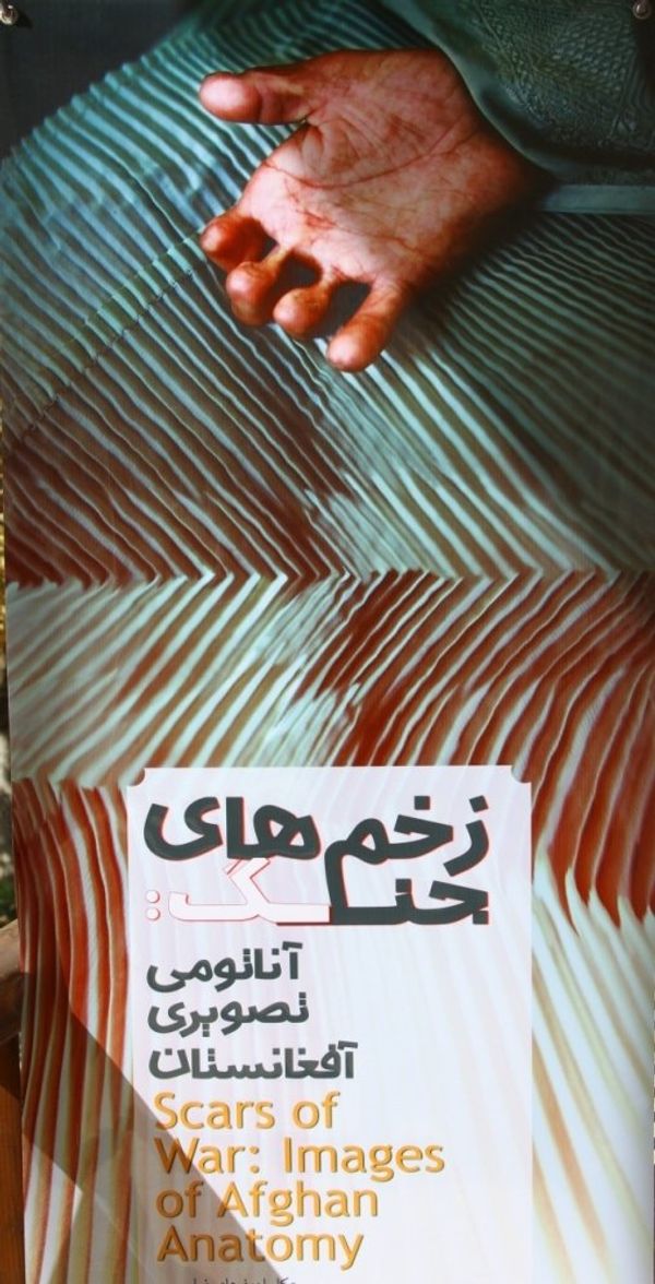 Afghanistan: the scars of war Afghanistan: the scars of war - Sputnik International