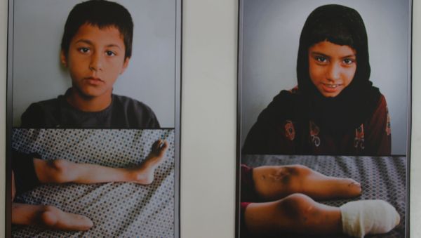 Afghanistan: the scars of war Afghanistan: the scars of war - Sputnik International