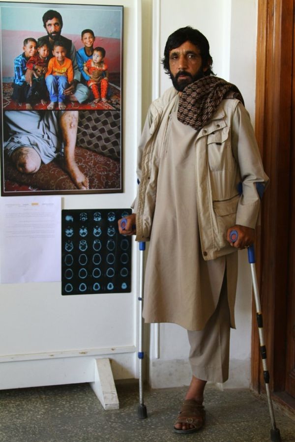 Afghanistan: the scars of war Afghanistan: the scars of war - Sputnik International