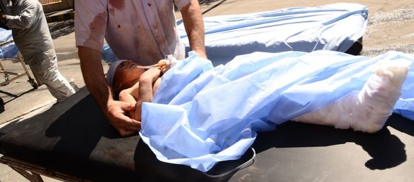 A wounded Syrian child is rushed into a hospital after she was hit by mortar shells that targeted Aleppo's government controlled Aziziyah and Suleimaniyah neighbourhoods on September 28, 2016 A wounded Syrian child is rushed into a hospital after she was hit by mortar shells that targeted Aleppo's government controlled Aziziyah and Suleimaniyah neighbourhoods on September 28, 2016 - Sputnik International