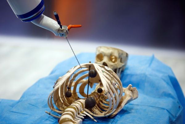 Some robots were created to assist surgeons during operations. This one, designed by China’s Siasun Robot and Automation Corporation, simulates the use of a medical instrument on a model of a human skeleton at the World Robot Conference in Beijing on October 21, 2016. Some robots were created to assist surgeons during operations. This one, designed by China’s Siasun Robot and Automation Corporation, simulates the use of a medical instrument on a model of a human skeleton at the World Robot Conference in Beijing on October 21, 2016. - Sputnik International