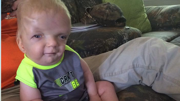 Terminally Ill Toddler Becomes Cruel Viral Meme, Mother Fighting to Stop It Spreading - Sputnik International